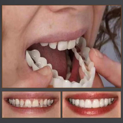 Dentier Amovible - Pour Un Sourire Plus Confiant